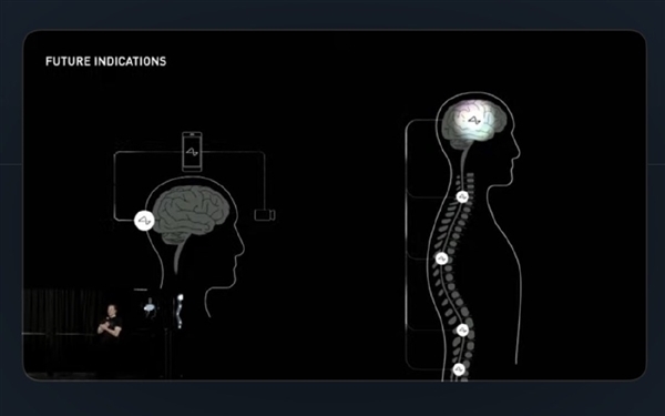 马斯克脑机接口实验新进展：首位患者能用意念下棋了