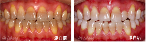 甘草片和红药水等为什么买不到了：知道真相的我有点慌