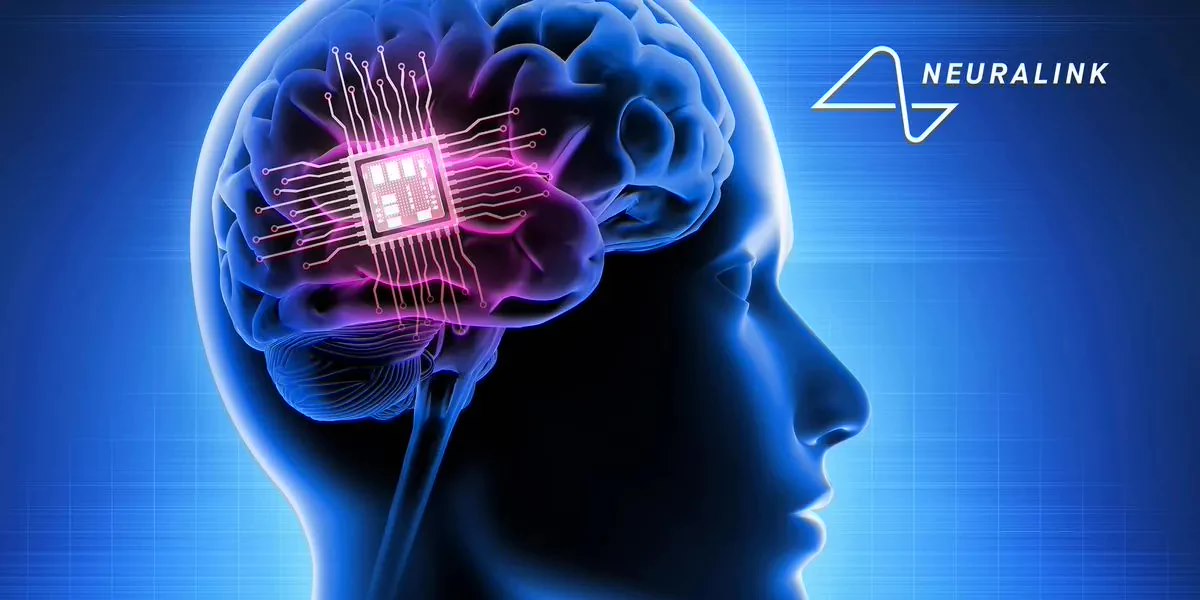 马斯克脑机接口公司 Neuralink 启动植入物研究，计划招募三名患者