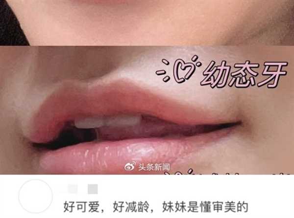 幼态审美盯上女生的牙齿：宝宝碗、宝宝针之后 宝宝牙也来了