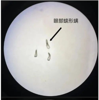 那些纹美瞳线的人 现在都怎么样了？