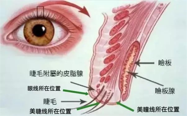 那些纹美瞳线的人 现在都怎么样了？