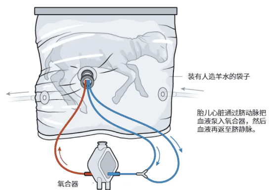 飙上热搜的人造子宫 真的能让男人也怀孕？